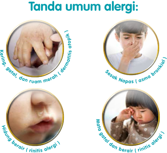 Jual Obat Herbal Alergi Surabaya Sidoarjo