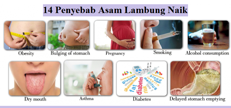 Jual Obat Asam Lambung Surabaya 